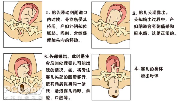 分娩第二期