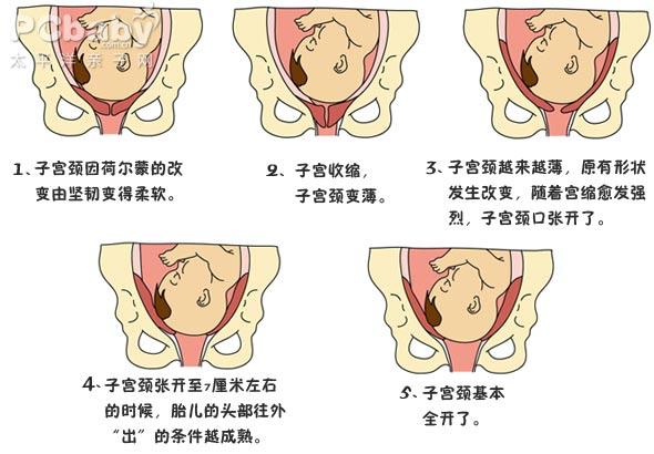 分娩1期子宫颈的变化